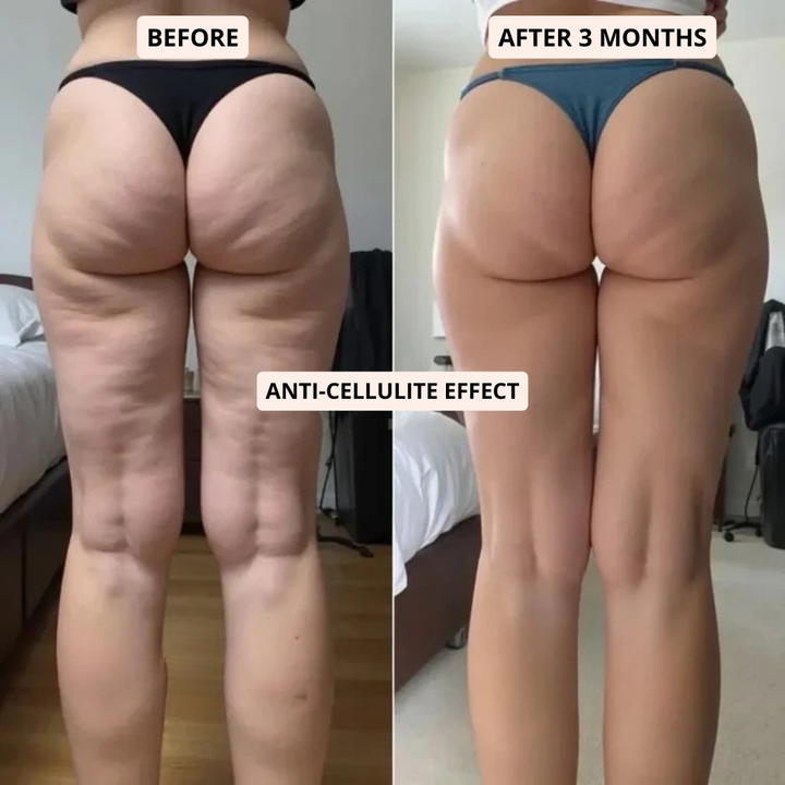 HARPER - 3-IN-1 SCULPTING & ANTI-CELLULITE LEGGING